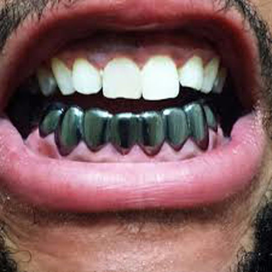 6/6 Black Gold Plated Grillz